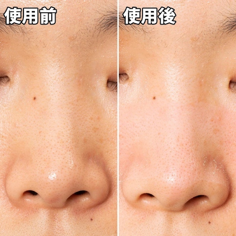 玩鼻親綠茶緊緻鼻膜 8