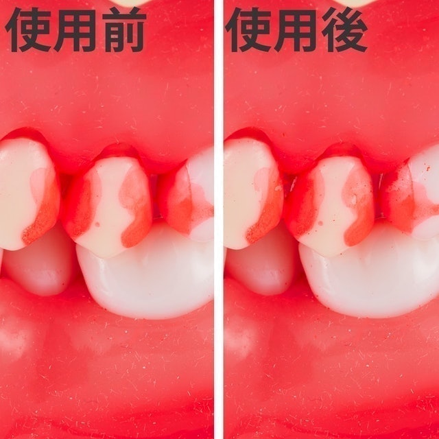 Ruscello 牙間刷 4S 6