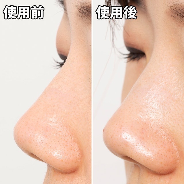 清潔毛孔黑色妙鼻貼 6