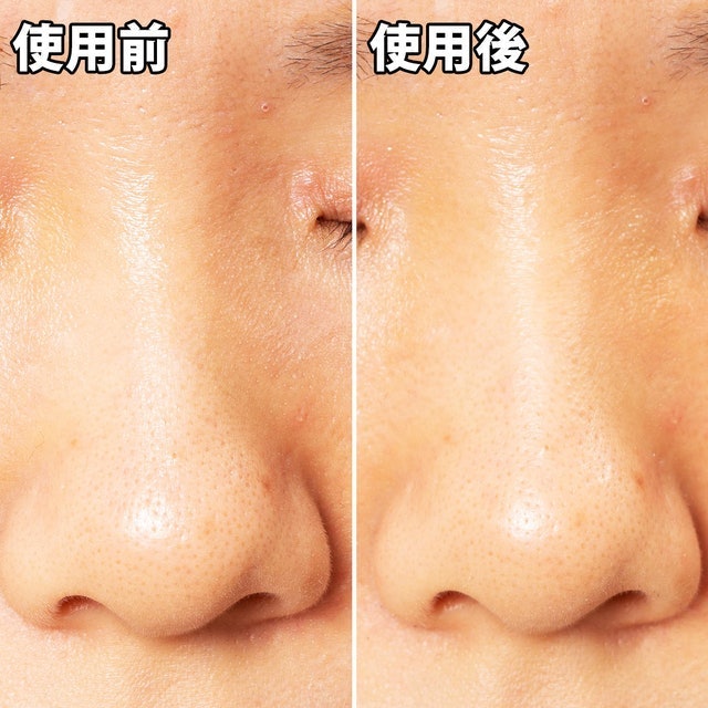 黑頭面膜 5