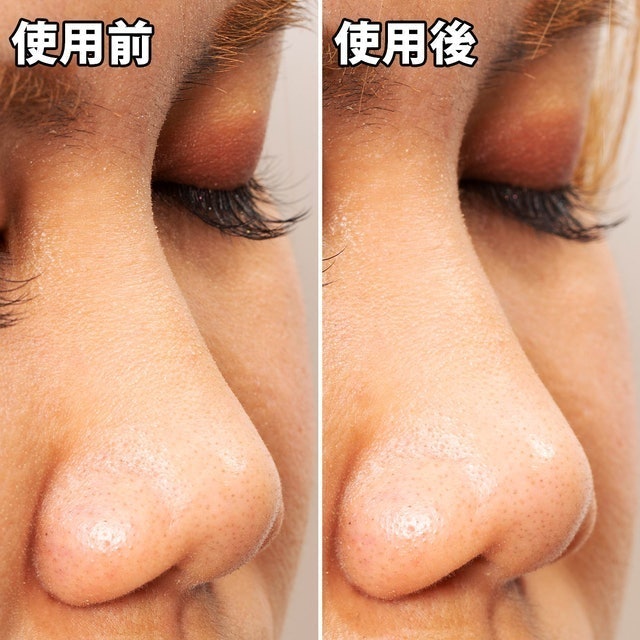 Pore’s Care 黑炭妙鼻貼 10