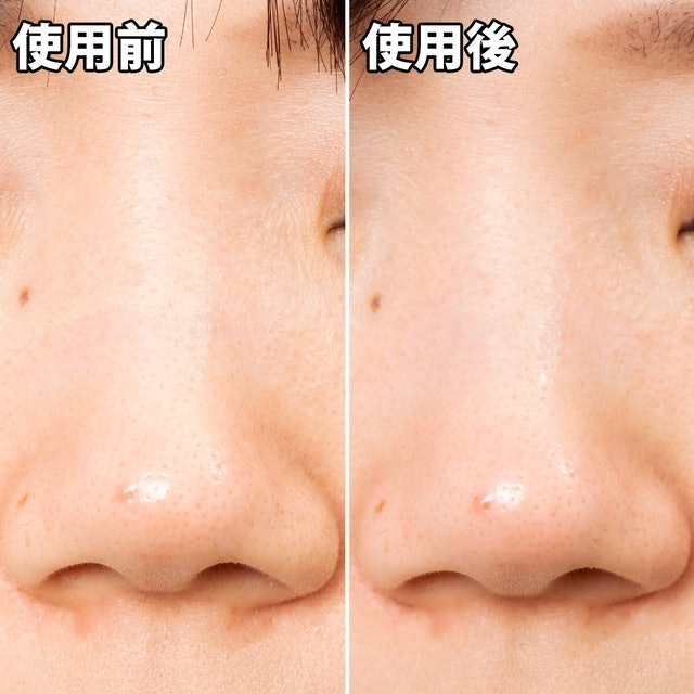 清潔毛孔黑色妙鼻貼 5