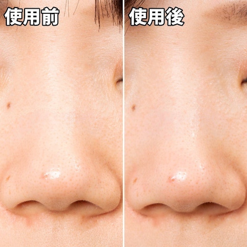 清潔毛孔黑色妙鼻貼 5