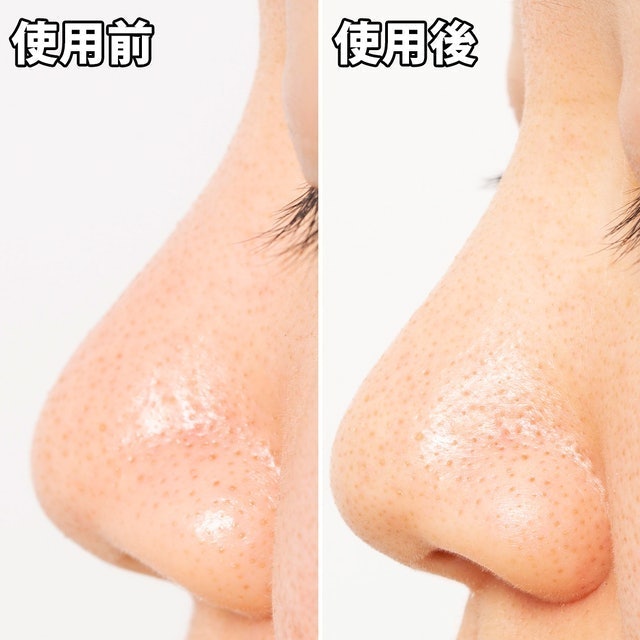 Pore’s Care 黑炭妙鼻貼 6