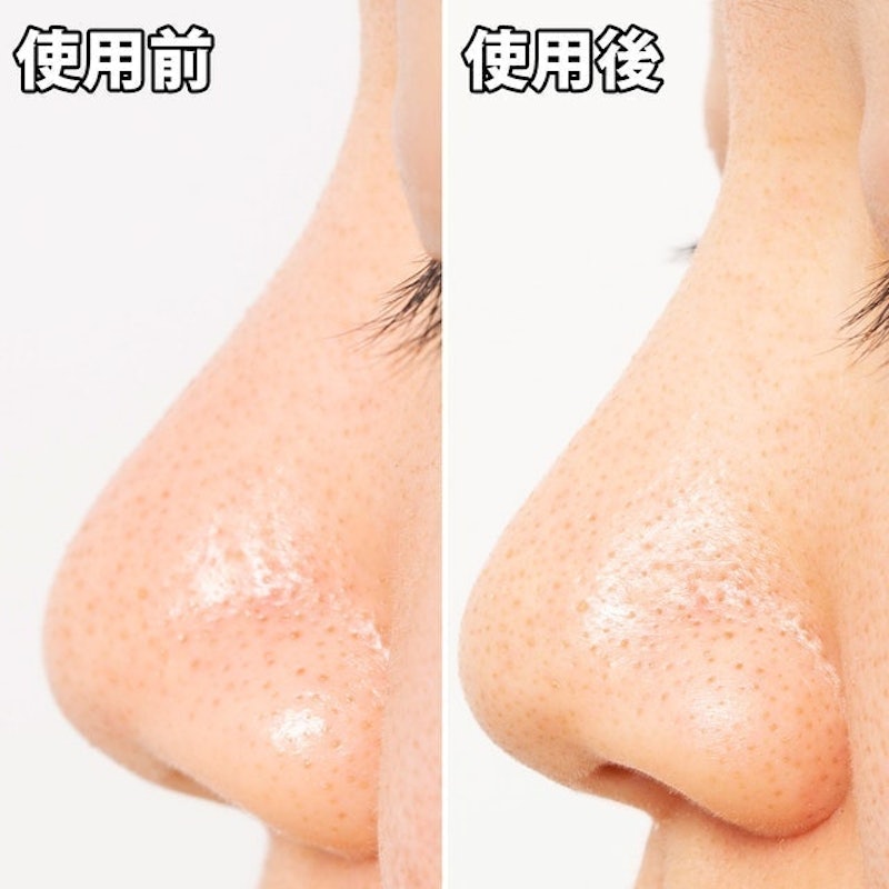 Pore’s Care 黑炭妙鼻貼 6