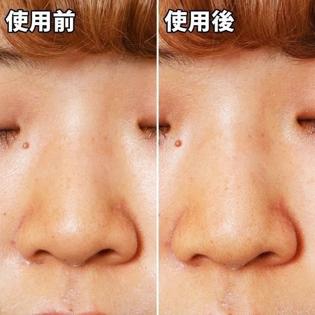 粉刺分手極凈鼻膜組 7