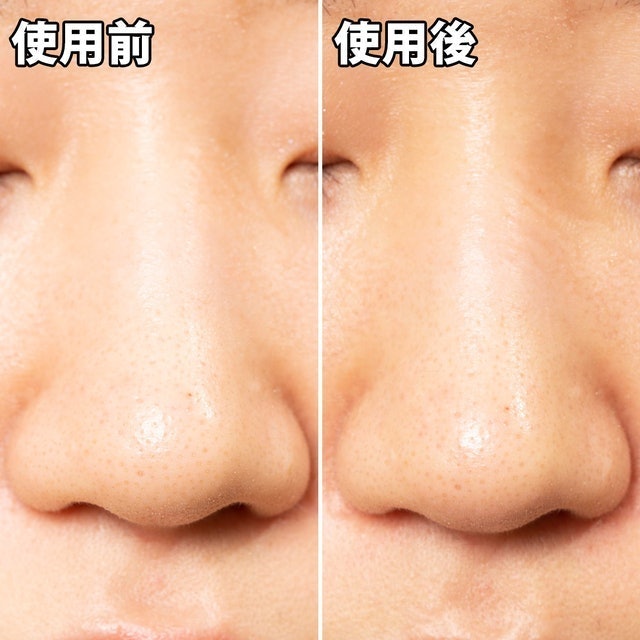 白金製藥 毛孔妙鼻貼炭貼布 5