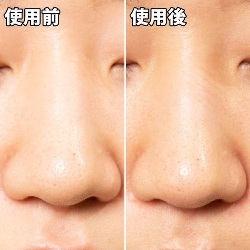 白金製藥 毛孔妙鼻貼炭貼布 5