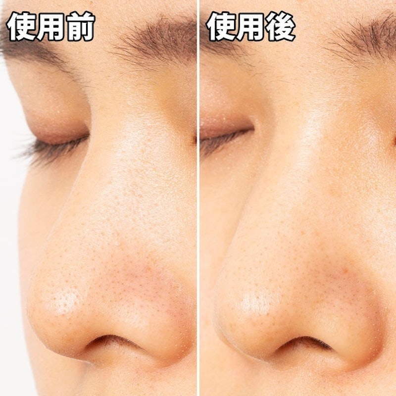 黑色妙鼻貼(女用) 9