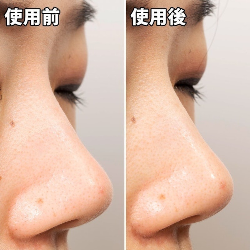 清潔毛孔黑色妙鼻貼 7